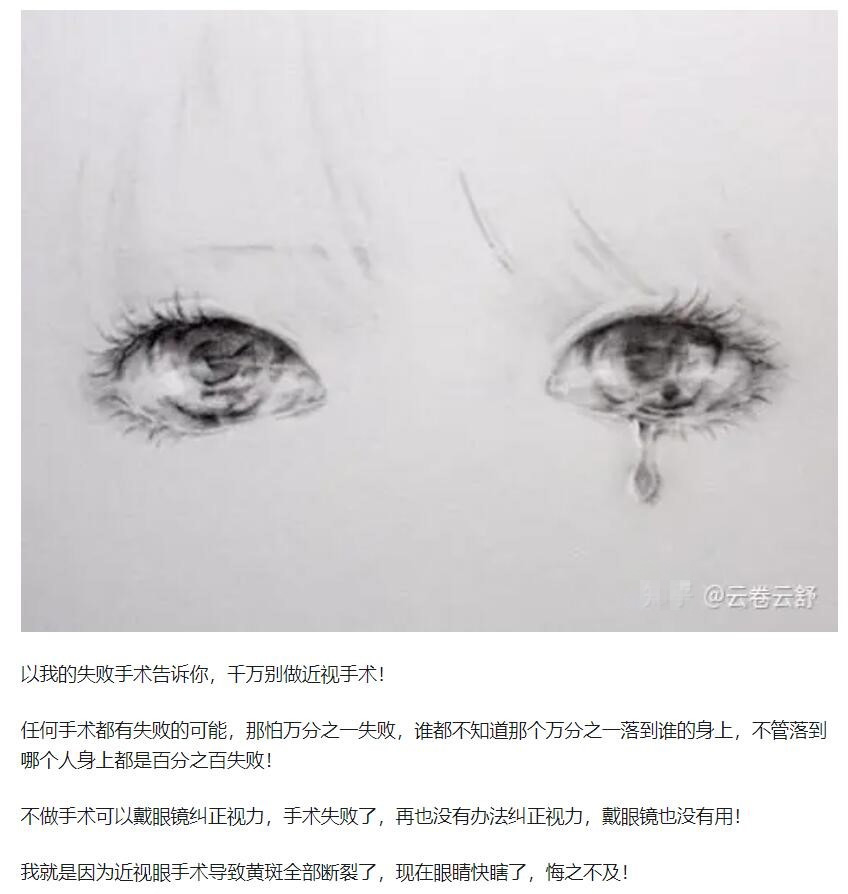 教你，怎樣去了解近視手術(shù)  